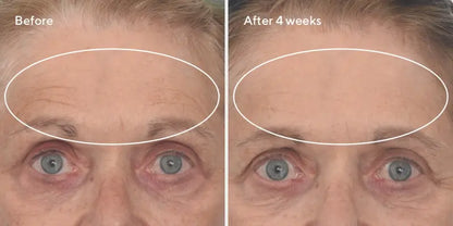 Retinal ReSculpt™ Overnight Treatment (30ml)